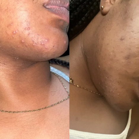 Cocoa Smoothie Face Cleanser — Targets acne, blemishes &amp; uneven tone image 2