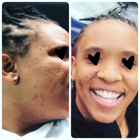 Cocoa Smoothie Face Cleanser — Targets acne, blemishes &amp; uneven tone image 1