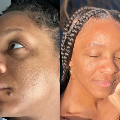Dream Drops – Balancing, Clarifying &amp; Hydrating Skin Treatment image 1