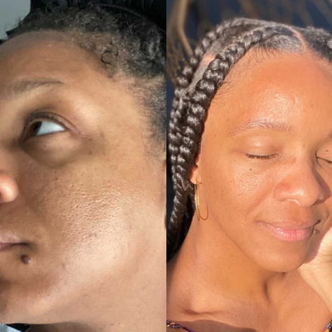 Dream Drops – Balancing, Clarifying &amp; Hydrating Skin Treatment image 1