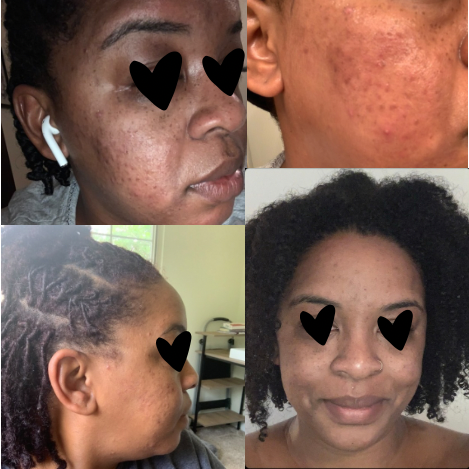 Cocoa Smoothie Face Cleanser — Targets acne, blemishes &amp; uneven tone image 3